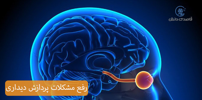 عوامل تاثیر گذار مشکلات پردازش دیداری در کودکان